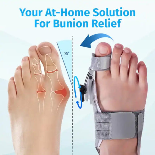 HalluxHealth™ Bunion Fix