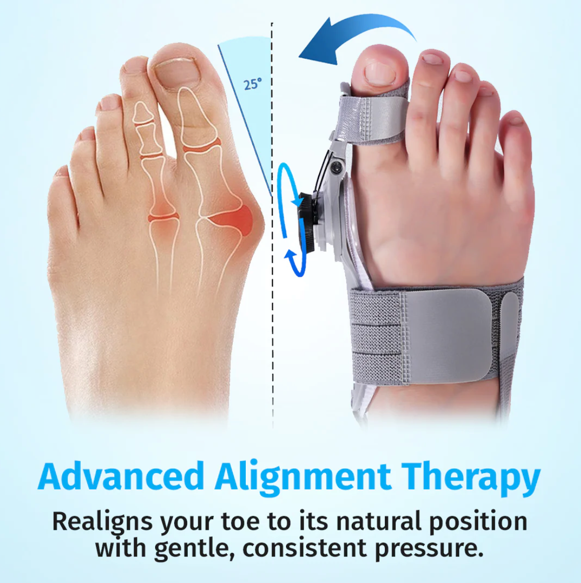 HalluxHealth™ Bunion Fix